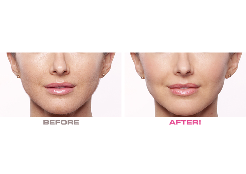 جهاز تقشير وإزالة شعر الوجه-Flawless Dermaplane Glo جهاز تقشير وإزالة شعر الوجه-Flawless Dermaplane Glo أجهزة إزالة شعر الجسم