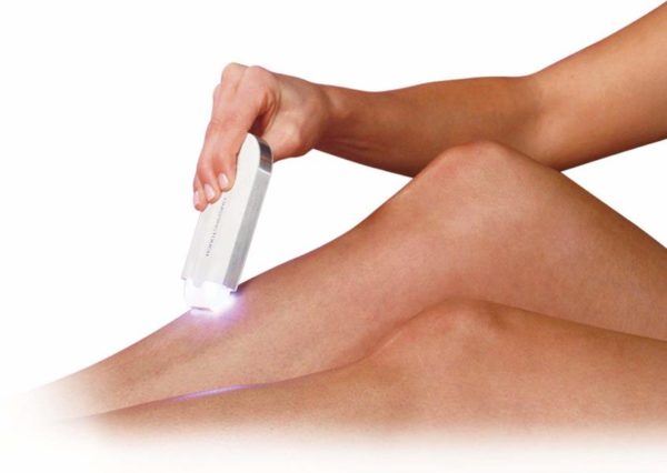 YES Hair removal device YES Hair removal device Electrical Hair Removals